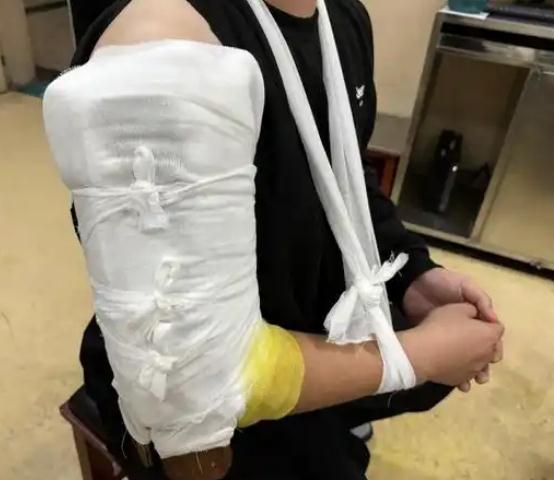两小伙与机器人掰手腕当场骨折