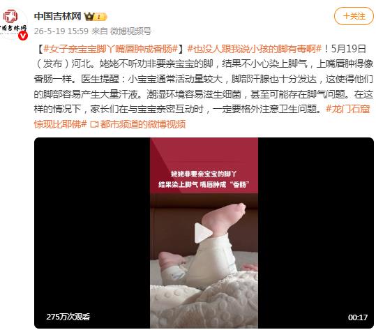 女子亲宝宝脚丫嘴唇肿成香肠 