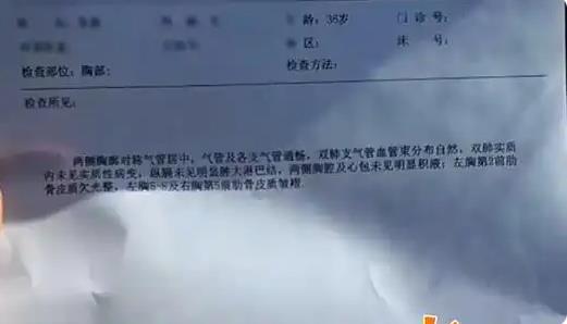 丈夫1个拥抱 妻子断了5根肋骨